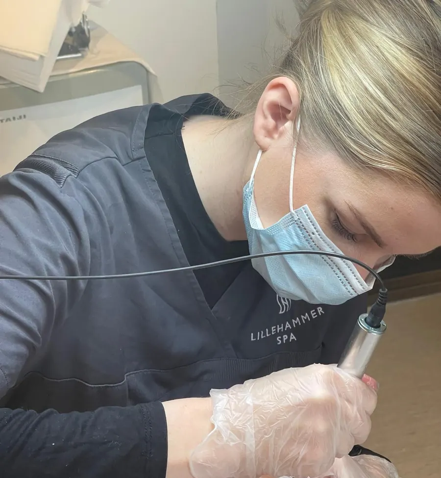 Terapeut hos Lillehammer SPA utfører microneedling