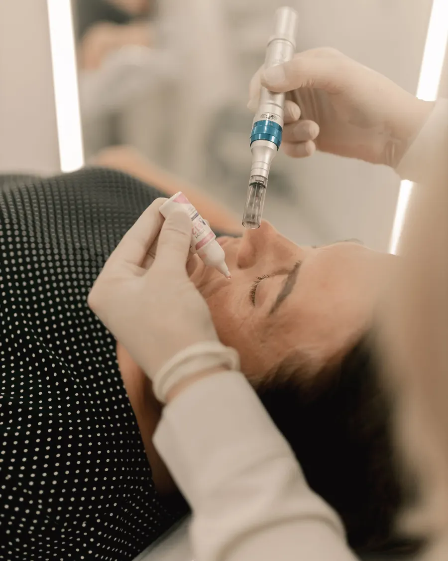 Microneedling-penn mot pannen
